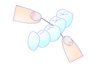 デンタルフロス