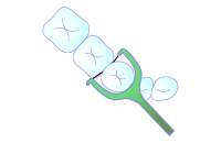 デンタルフロス